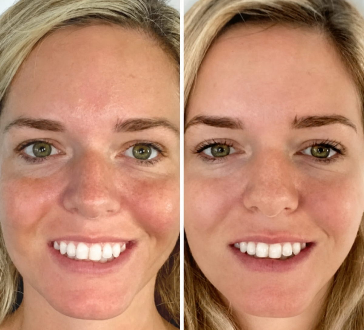 Side-by-side comparison of a woman's face with and without makeup.
